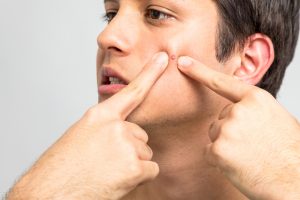 man popping pimple