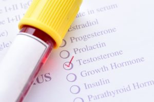 testosterone level test