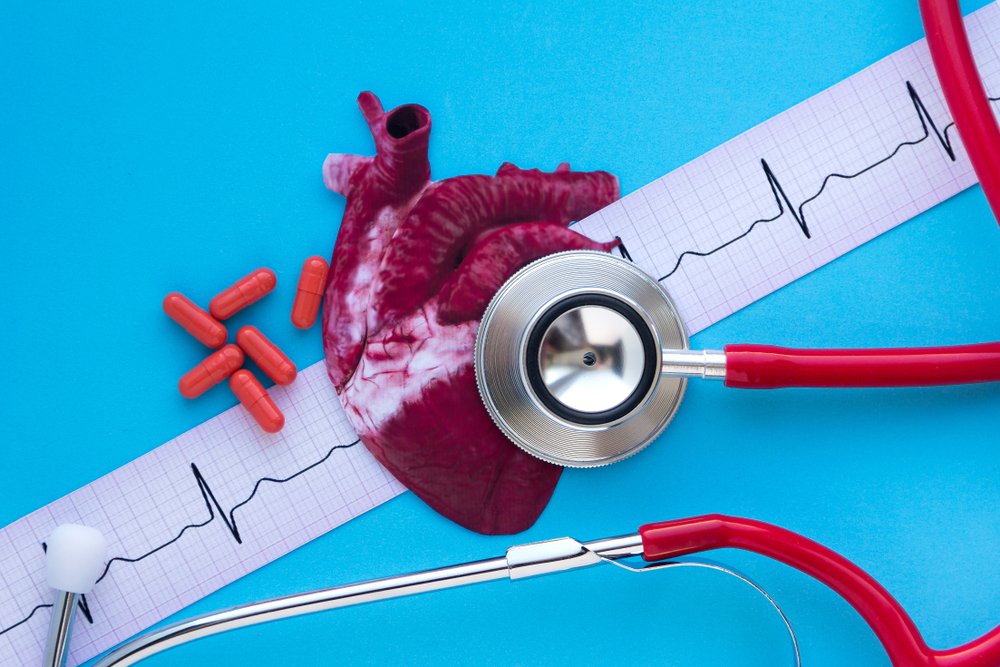 cardiogram and medications