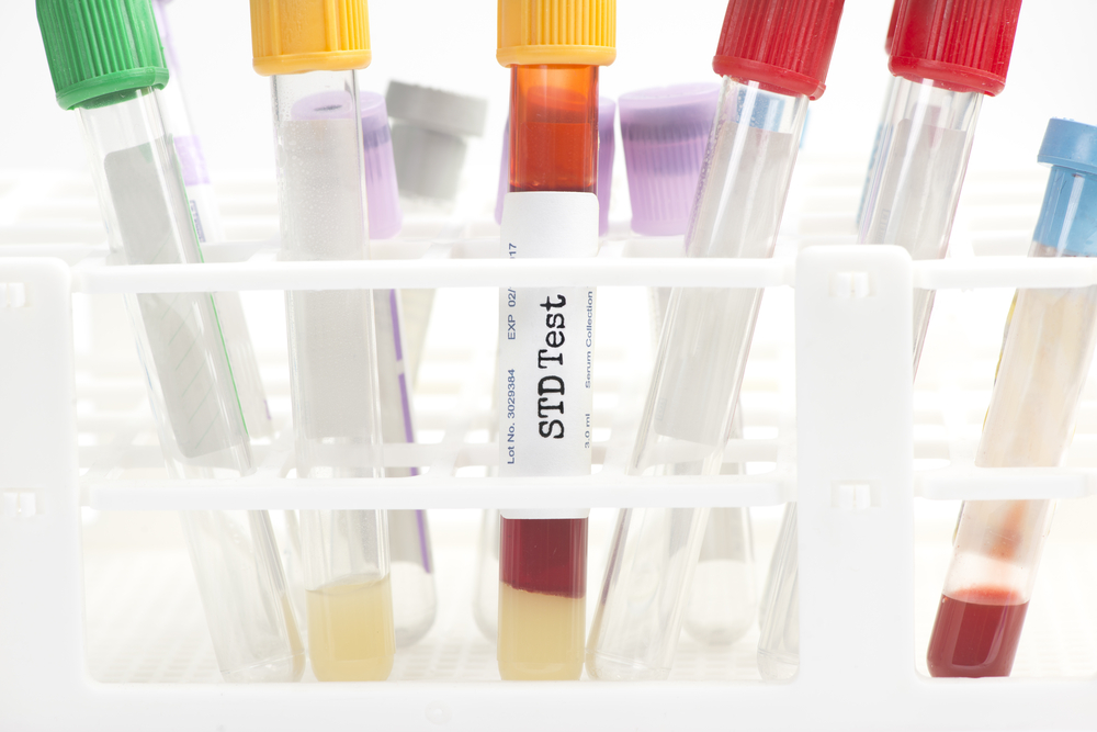 STD test blood samples
