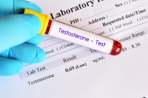 testosterone level test