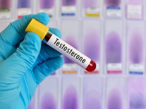 testosterone test on blood sample