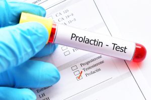 prolactin blood test