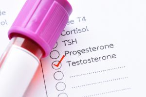 testosterone levels test