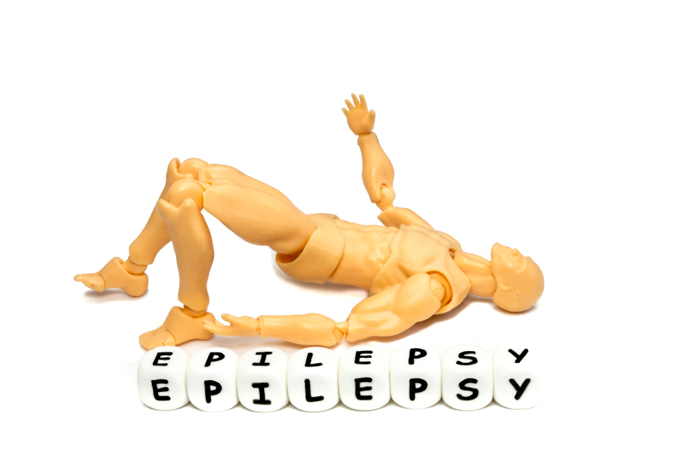 epilepsy and AEDs