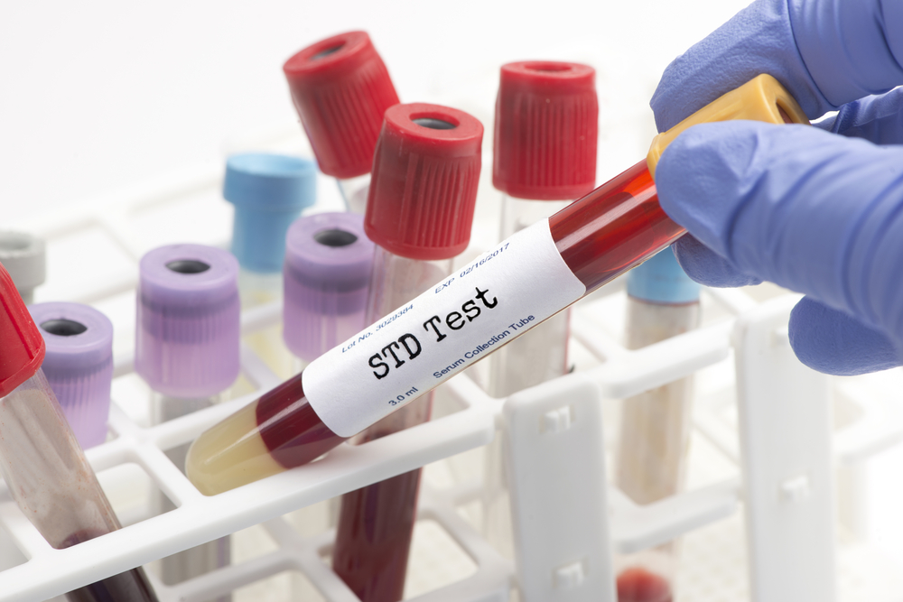 blood STD test
