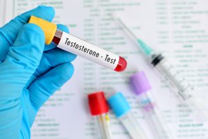 testosterone test on blood sample