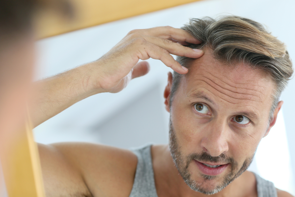 middle aged man hair loss