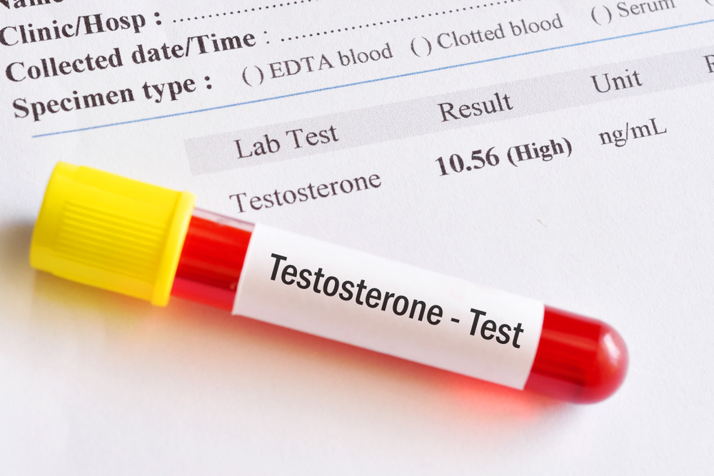 testosterone test high level
