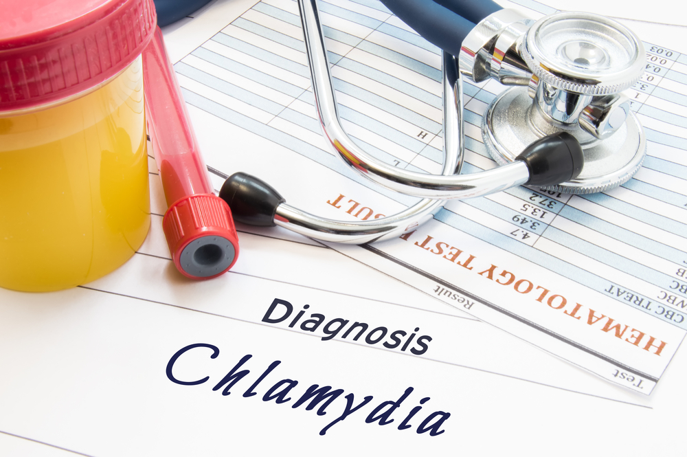 chlamydia diagnosis