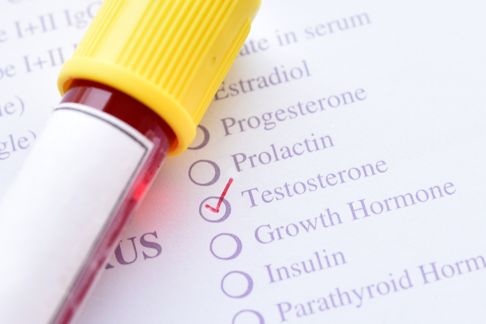 testosterone level blood test