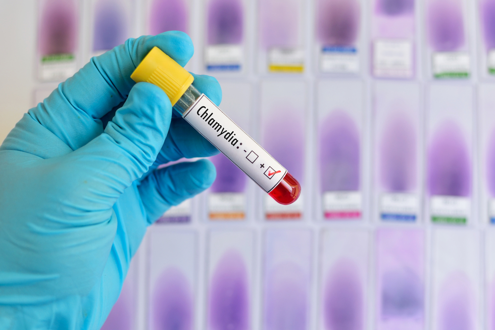 chlamydia blood test positive