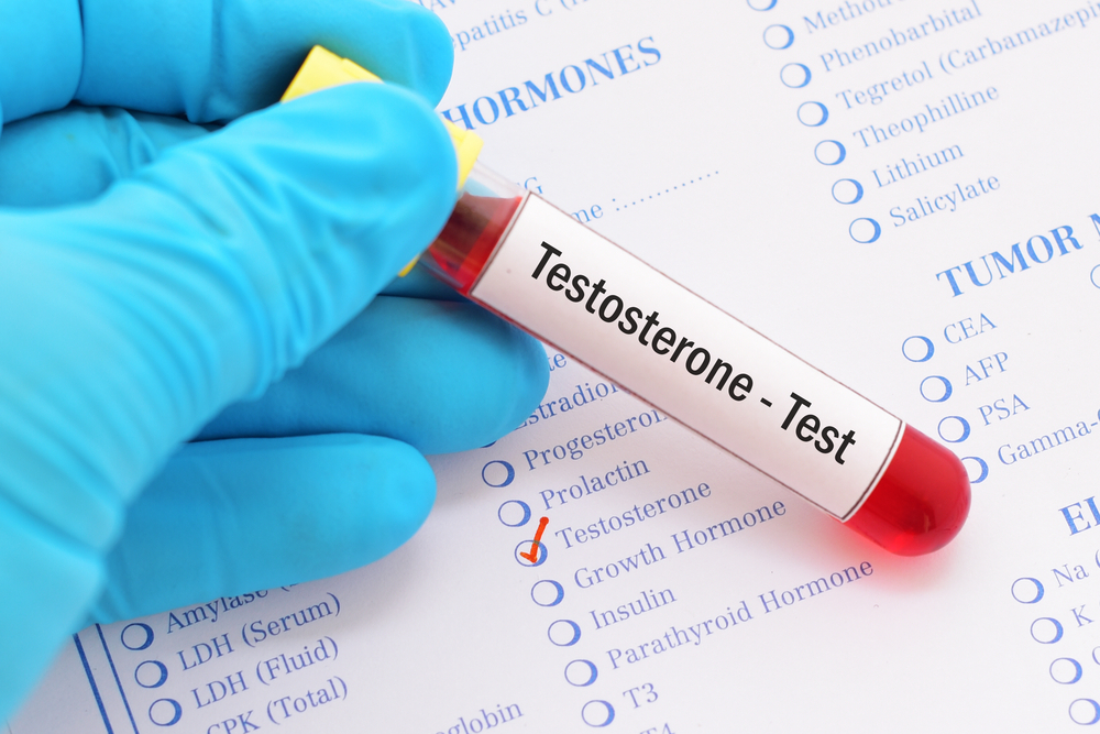 testosterone level blood test