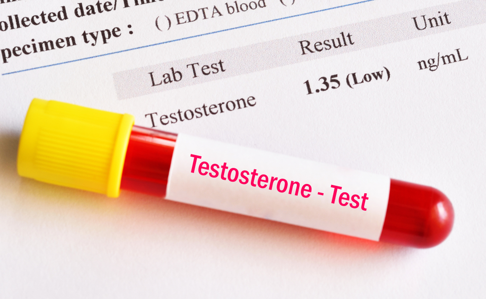 low testosterone level blood test result