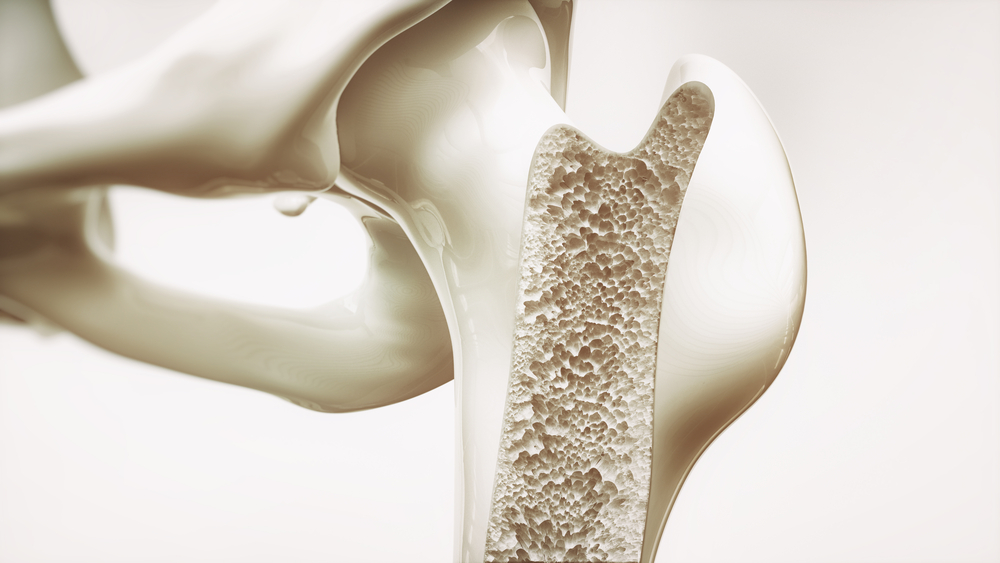 osteoporosis bone cross section