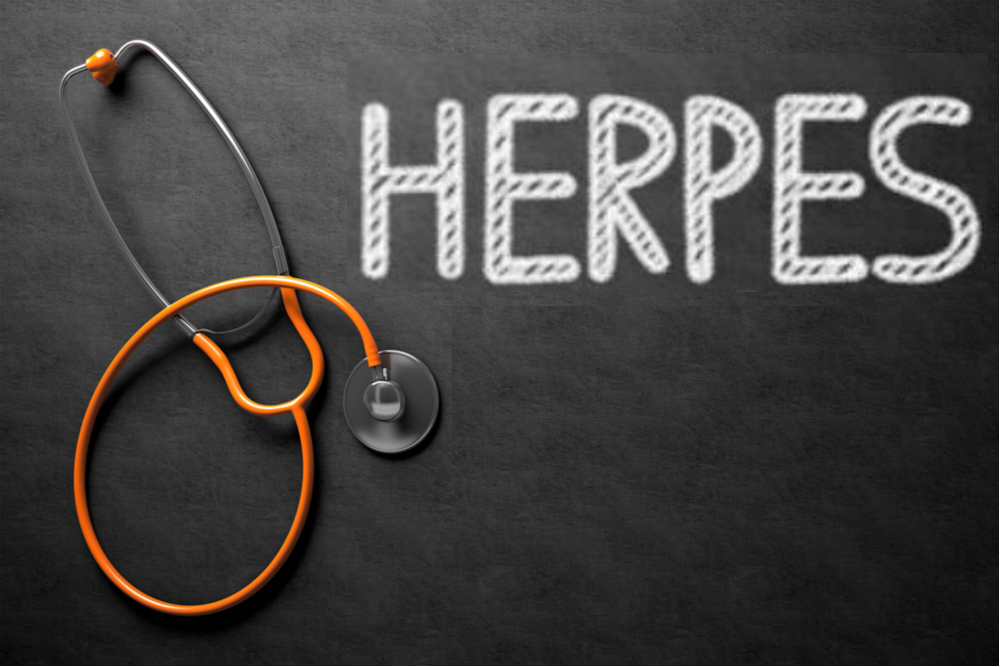 herpes medical condition