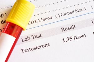 low testosterone lab test result