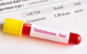 low testosterone level test result