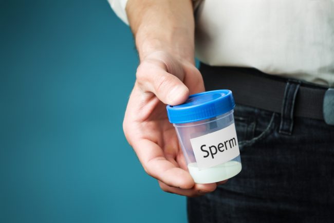 sperm sample