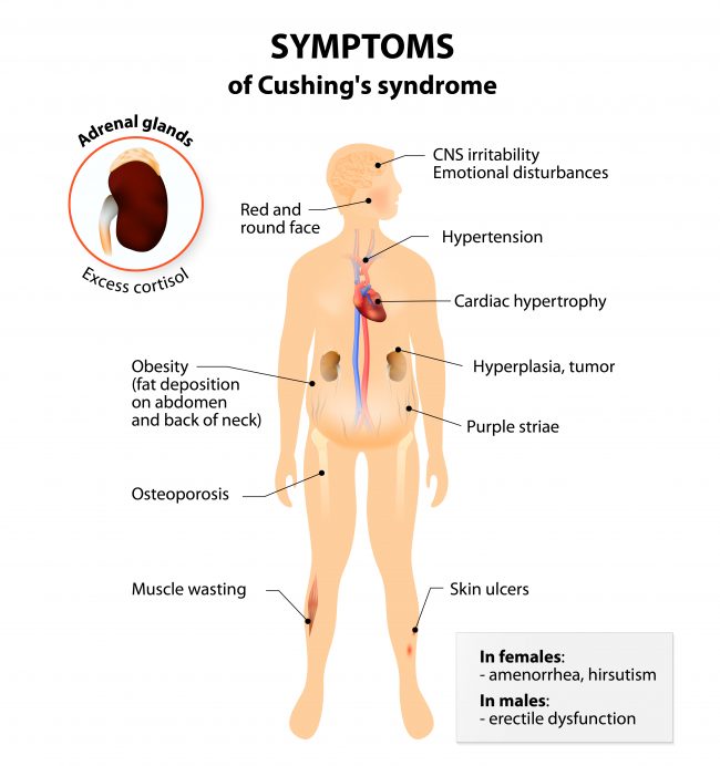 cushing syndrome symptoms